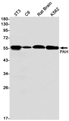 1 - PAH Rabbit mAb AP74871