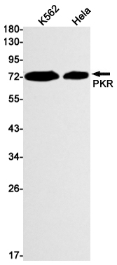 1 - PKR Rabbit mAb AP74872