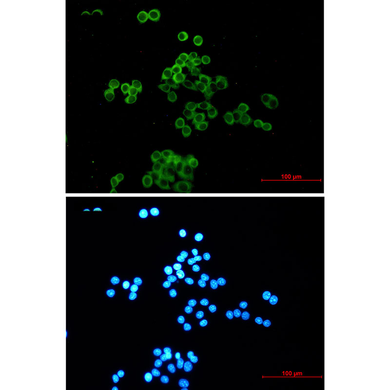 1 - Desmocollin 3 Rabbit mAb AP74874
