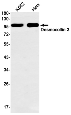 3 - Desmocollin 3 Rabbit mAb AP74874