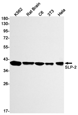 1 - SLP2 Rabbit mAb AP74881
