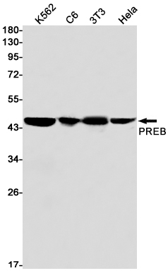1 - PREB Rabbit mAb AP74885