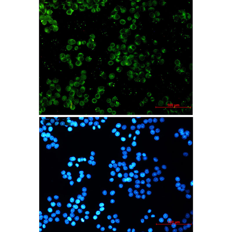 1 - TREX1 Rabbit mAb AP74886