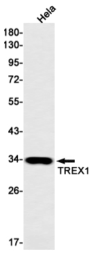 2 - TREX1 Rabbit mAb AP74886