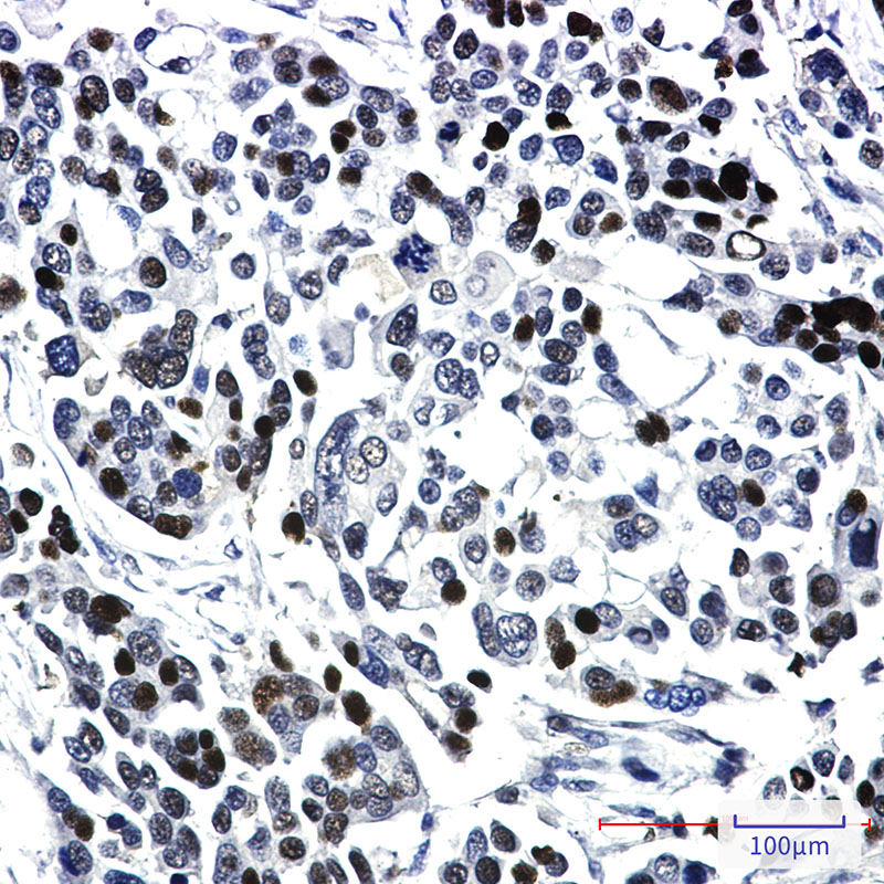 2 - KAT13A/SRC1 Rabbit mAb AP74887