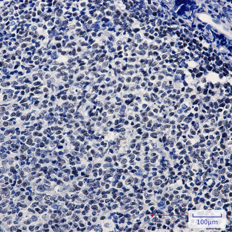 2 - KAT1 Rabbit mAb AP74888
