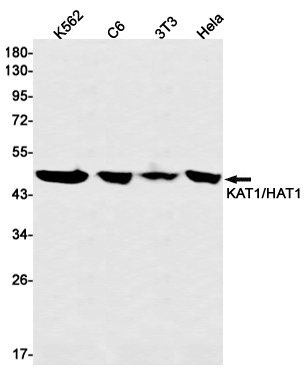 1 - KAT1 Rabbit mAb AP74888