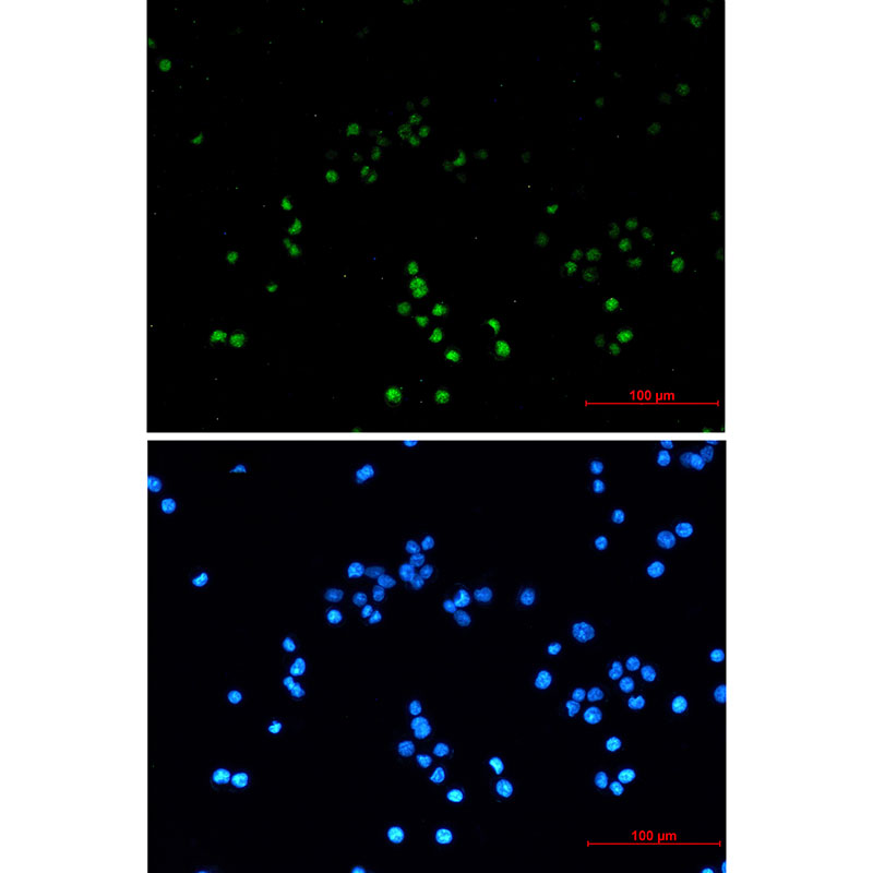 8 - ZHX2 Rabbit mAb AP74891