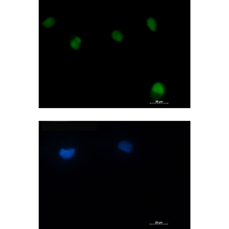 1 - ATM Rabbit mAb AP74893