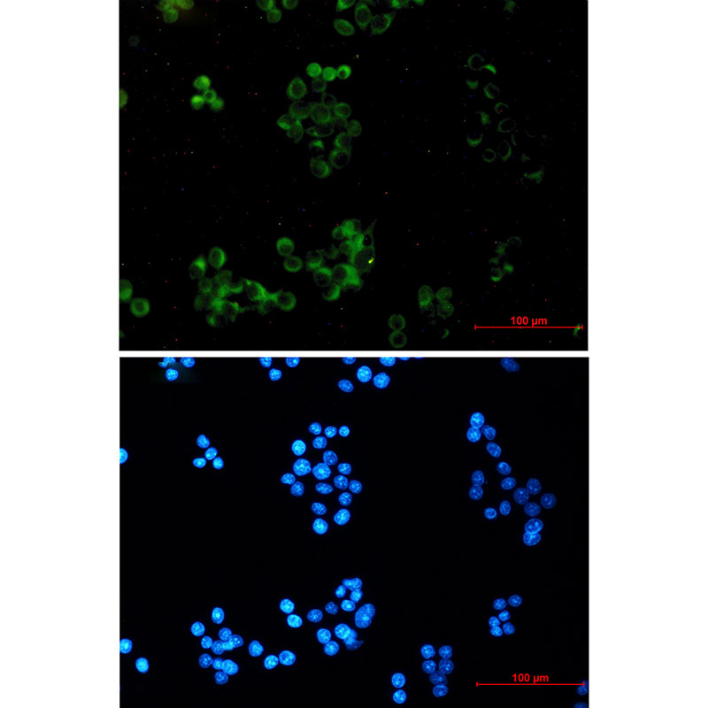 1 - Amyloid Precursor Protein Rabbit mAb AP74896