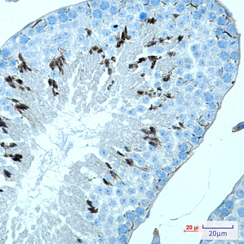 1 - MAGEC2 Rabbit mAb AP74903