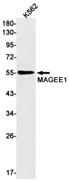 2 - MAGEC2 Rabbit mAb AP74903