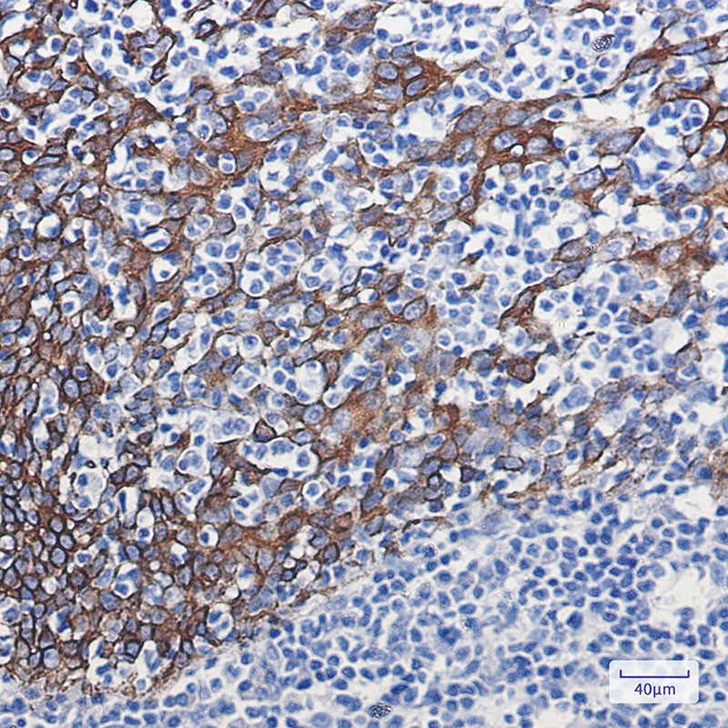 2 - Cytokeratin 16/K16 Rabbit mAb AP74904