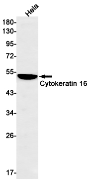 1 - Cytokeratin 16/K16 Rabbit mAb AP74904