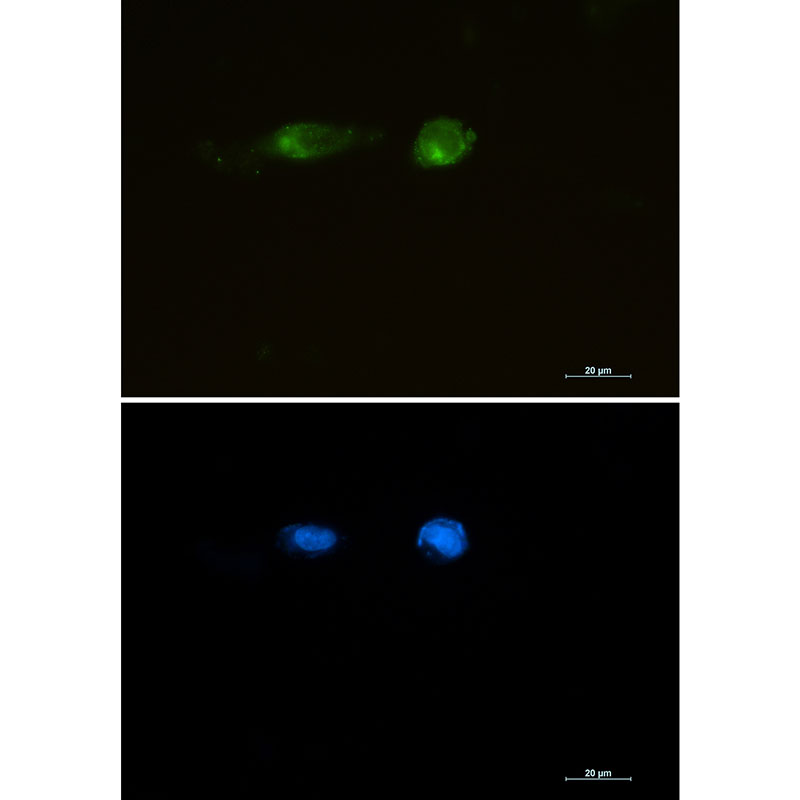 2 - [KO]LRP1 Rabbit mAb AP74905