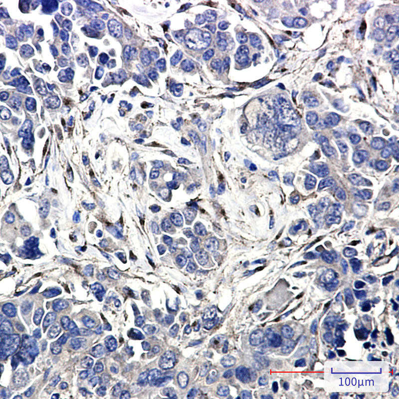 5 - [KO]LRP1 Rabbit mAb AP74905