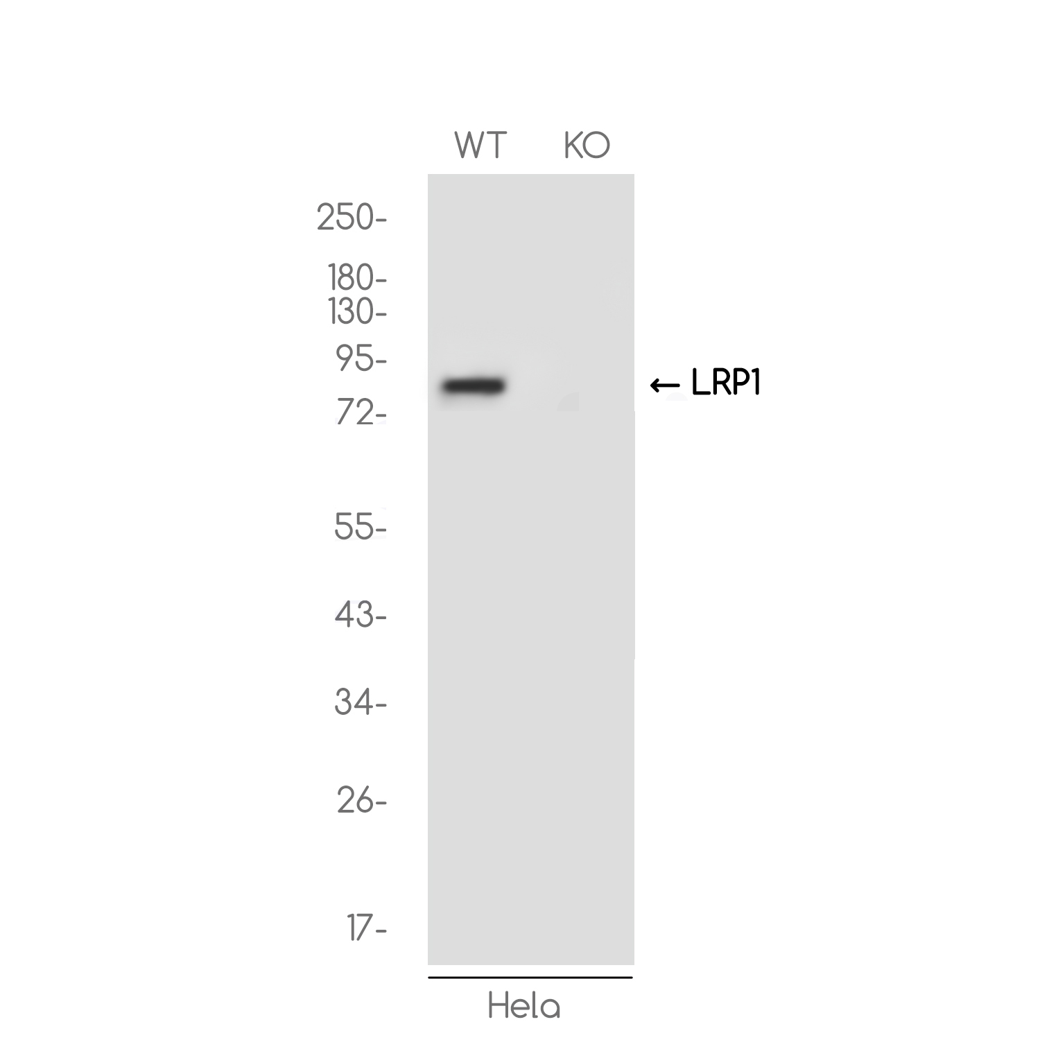 1 - [KO]LRP1 Rabbit mAb AP74905