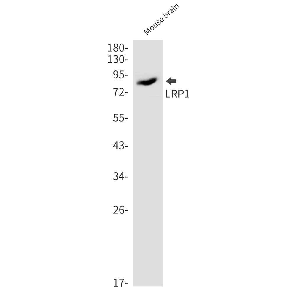 8 - [KO]LRP1 Rabbit mAb AP74905