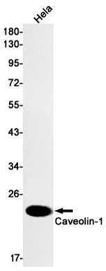 1 - Caveolin-1 Rabbit mAb AP74912