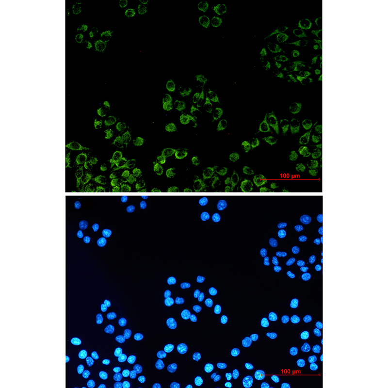 8 - PBR Rabbit mAb AP74914