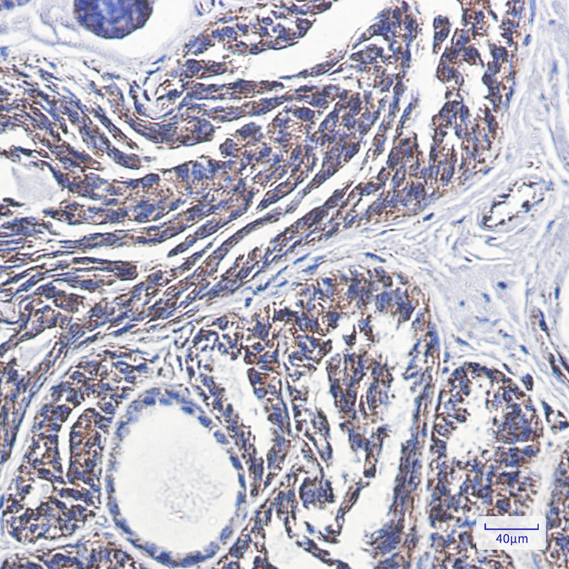 2 - PBR Rabbit mAb AP74914