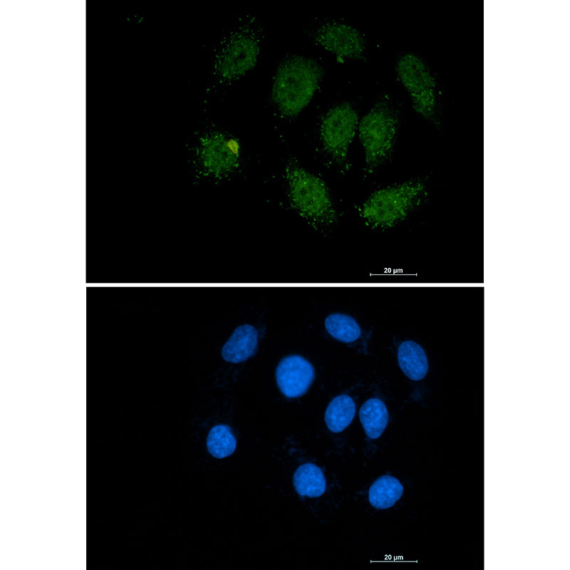 1 - Smad3 Rabbit mAb AP74916