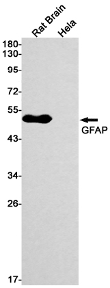 1 - GFAP Rabbit mAb AP74917