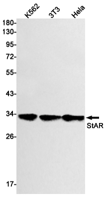 1 - StAR Rabbit mAb AP74919