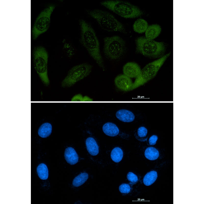1 - Profilin 1 Rabbit mAb AP74920