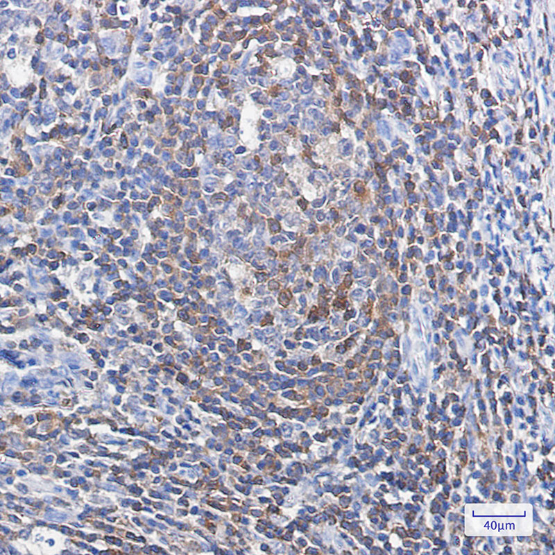 8 - Profilin 1 Rabbit mAb AP74920
