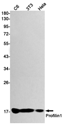2 - Profilin 1 Rabbit mAb AP74920
