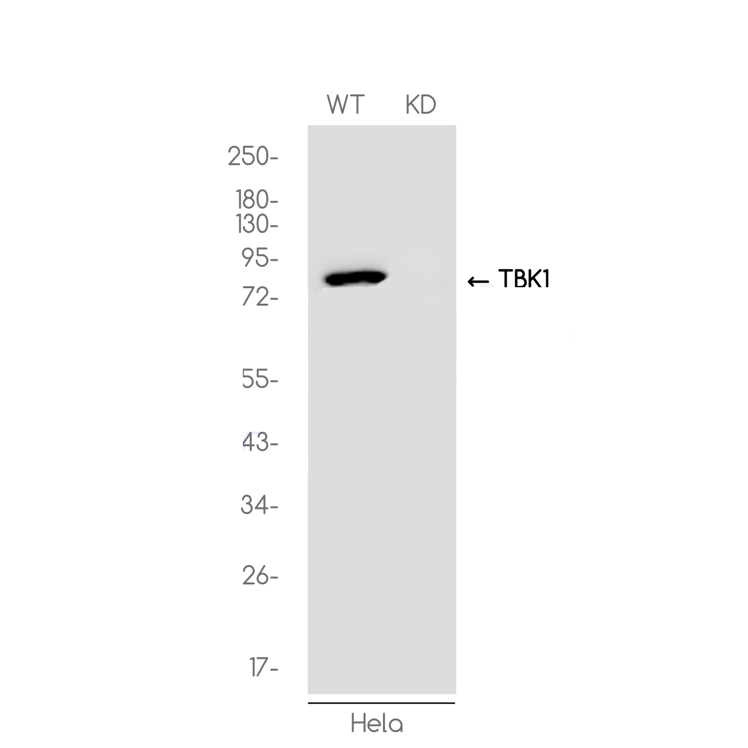 1 - [KD]NAK/TBK1 Rabbit mAb AP74921