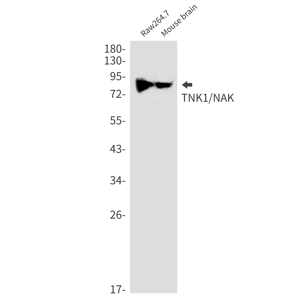 2 - [KD]NAK/TBK1 Rabbit mAb AP74921