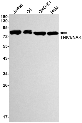 5 - [KD]NAK/TBK1 Rabbit mAb AP74921