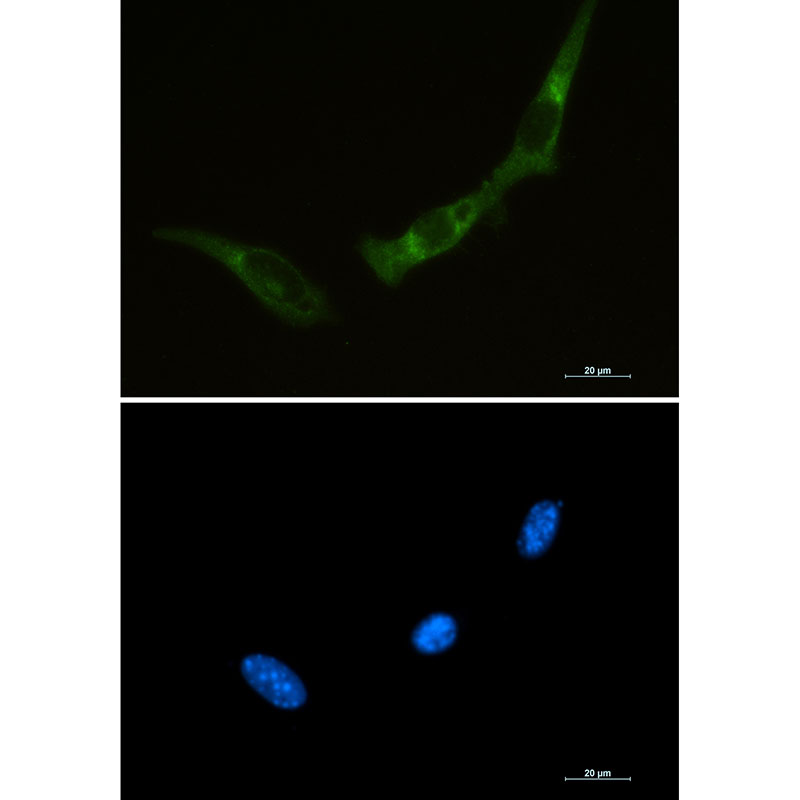 1 - PKR Rabbit mAb AP74922