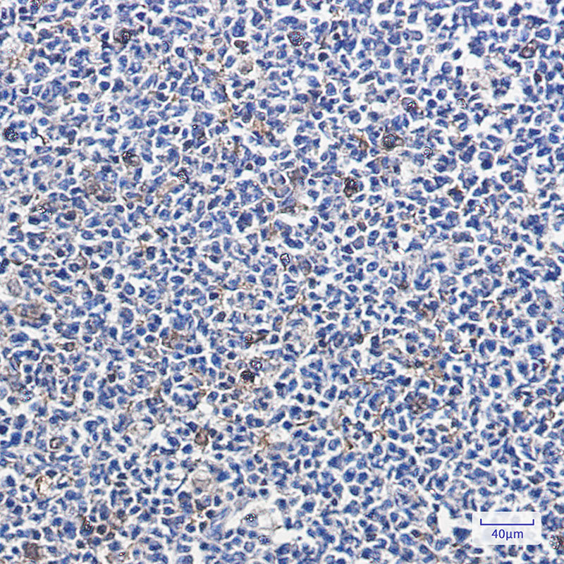 2 - PARK7/DJ1 Rabbit mAb AP74923