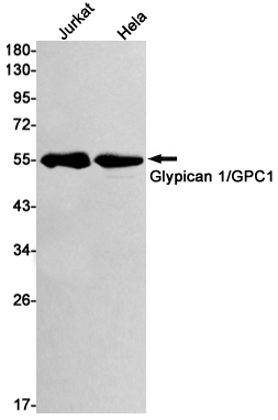 1 - Glypican 1/ GPC1 Rabbit mAb AP74927