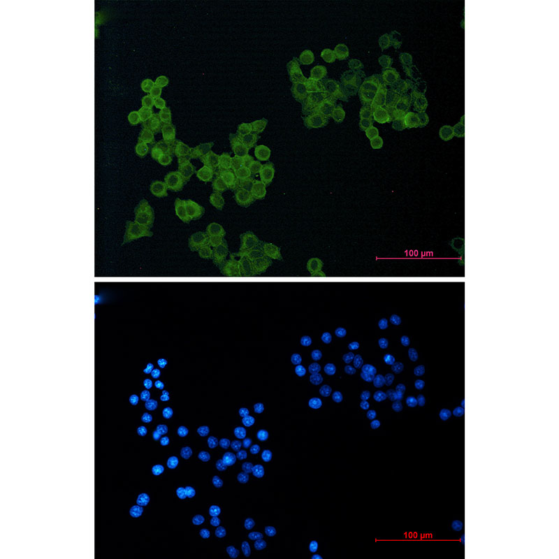 1 - CD146 Rabbit mAb AP74935