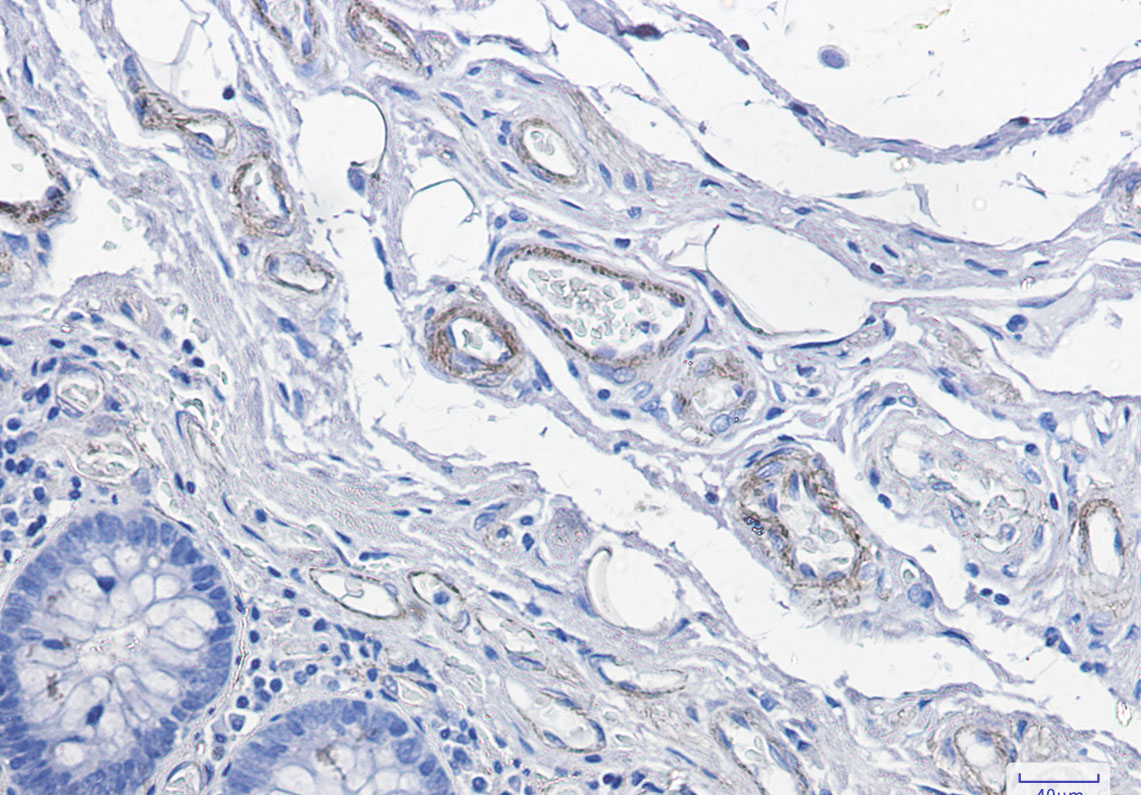 8 - CD146 Rabbit mAb AP74935