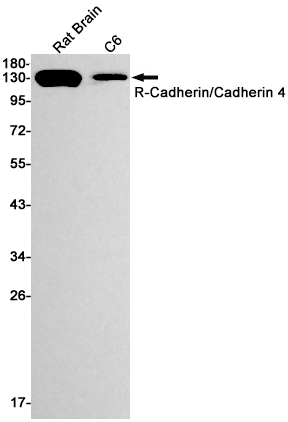 0 - R Cadherin Rabbit mAb AP74946