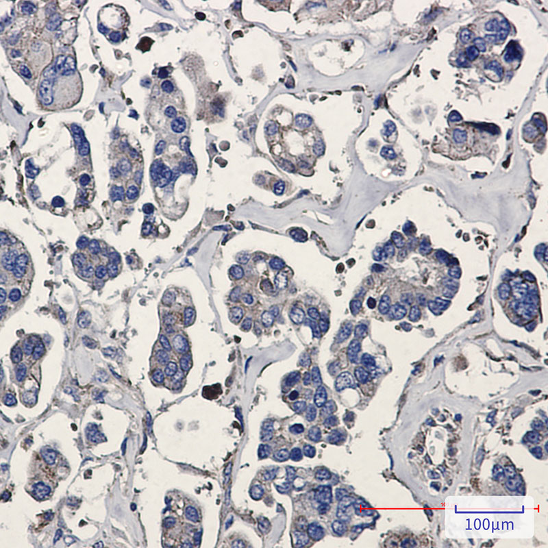 2 - [KO]ARPC5/p16 ARC Rabbit mAb AP74950
