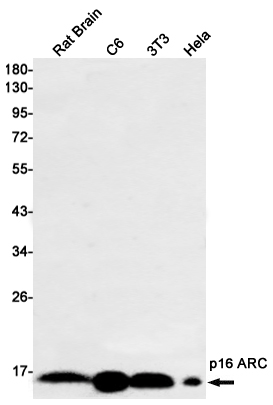 1 - [KO]ARPC5/p16 ARC Rabbit mAb AP74950