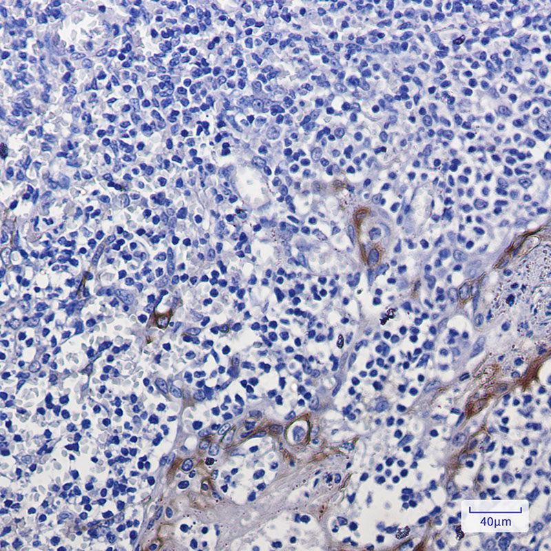 8 - Cytokeratin 10 Rabbit mAb AP74951