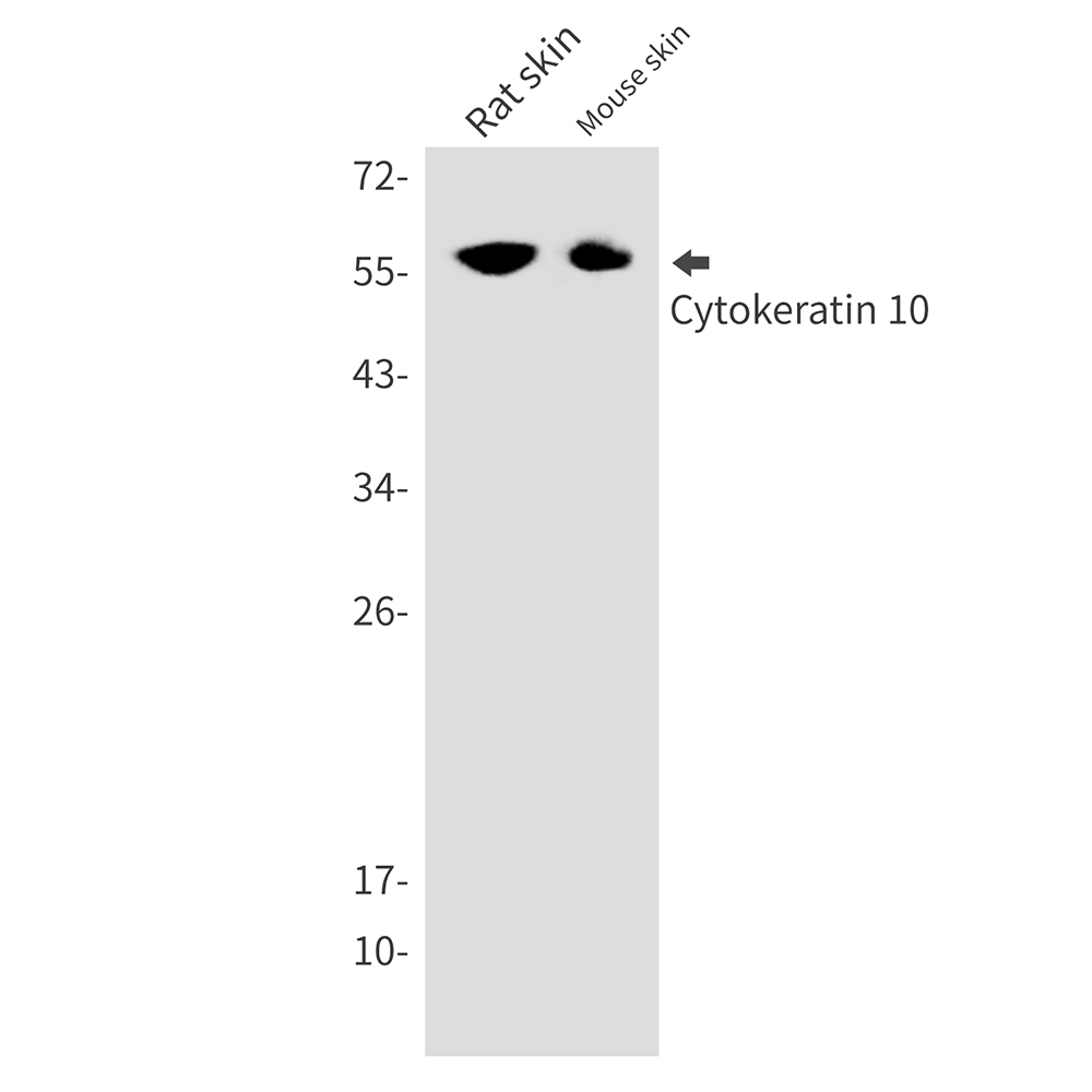 1 - Cytokeratin 10 Rabbit mAb AP74951
