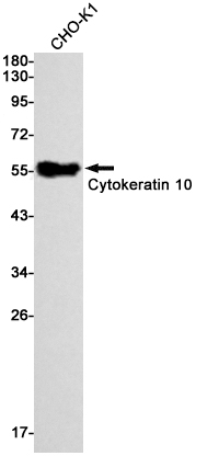 2 - Cytokeratin 10 Rabbit mAb AP74951