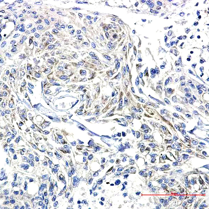 2 - Phospho-Synapsin I (Ser9) Rabbit mAb AP74955