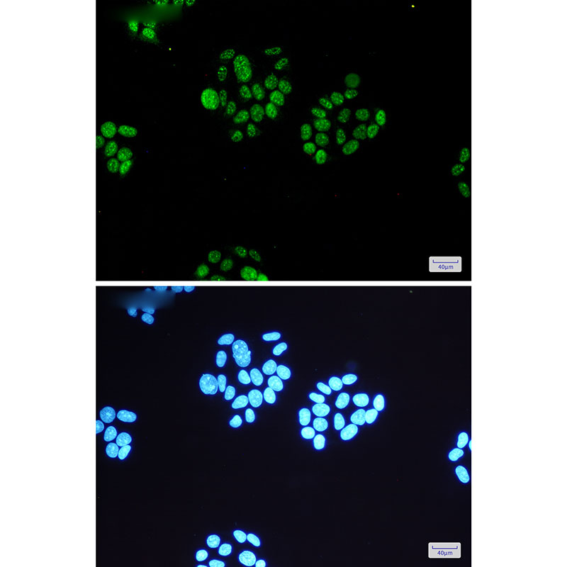 8 - Phospho-MSK1 (Ser360) Rabbit mAb AP74956