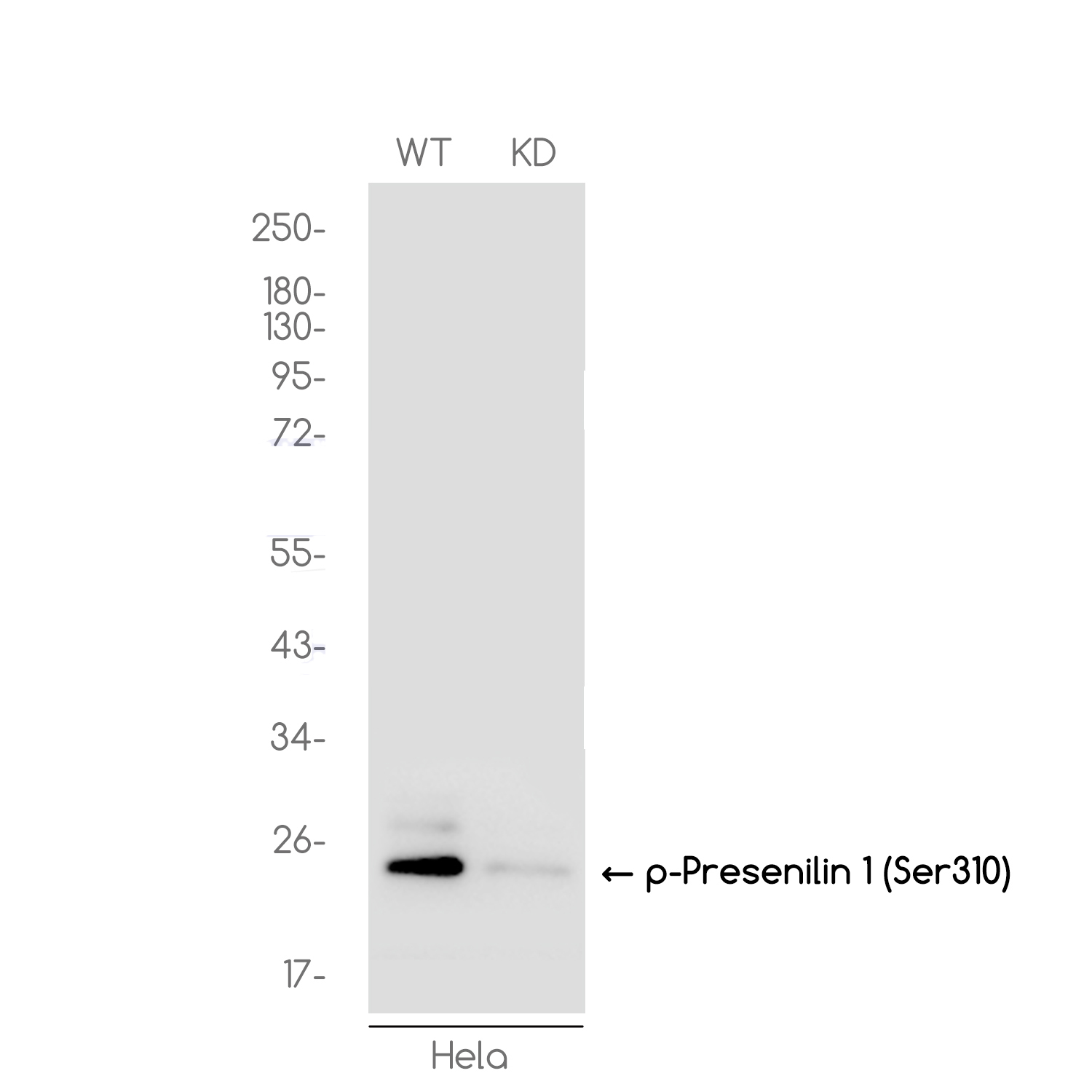1 - [KD]Phospho-Presenilin 1 (Ser310) Rabbit mAb AP74958
