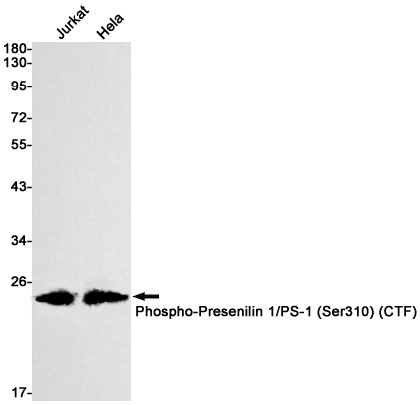 0 - [KD]Phospho-Presenilin 1 (Ser310) Rabbit mAb AP74958