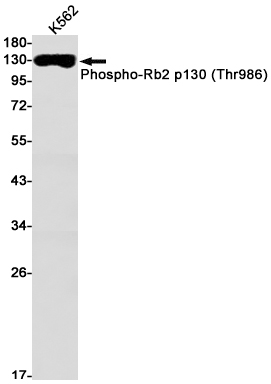 1 - Phospho-Rb2 p130 (Thr986) Rabbit mAb AP74961